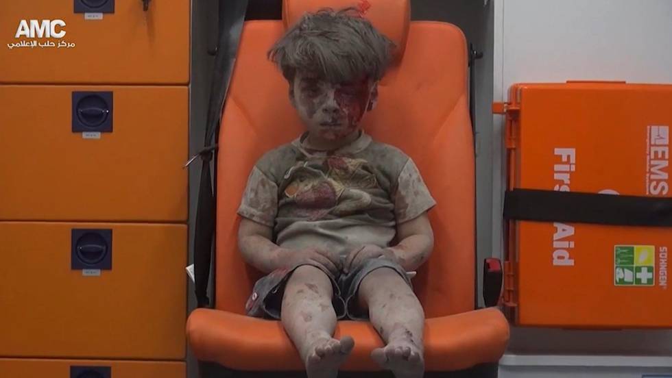 Omran Daqneesh menino Síria vídeo viral 2